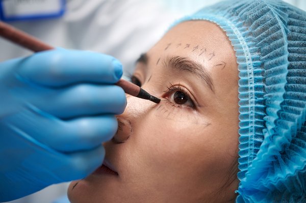 Transformez votre regard avec la blépharoplastie inférieure